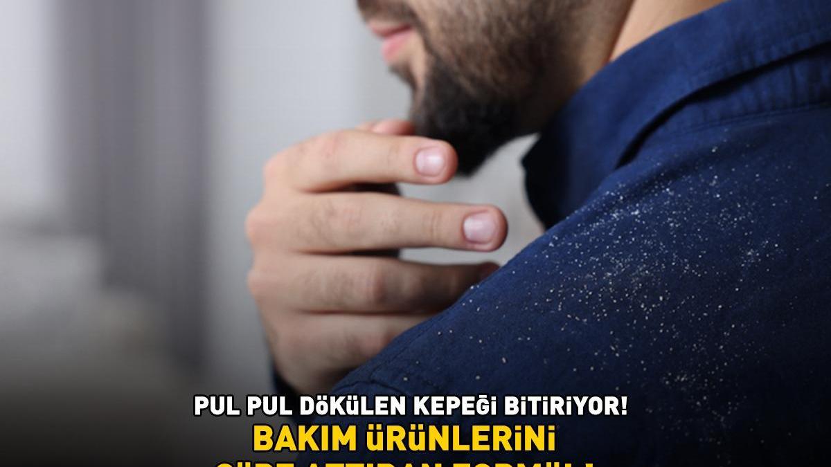 PUL PUL DÖKÜLEN KEPEĞİ BİTİRİYOR! Bakım ürünlerini çöpe attıran formül! ’30 dakika bekletmek yetiyor’